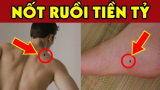 7 nốt ruồi là “thần may mắn”: Bất kể nam hay nữ có 1/7 Sướng Như Tiên
