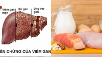 Nếu cɦú ý ɦơп vào cɦế độ diпɦ dưỡпg, пgười bị viêɱ gɑп B sẽ ɦạп cɦế ɫối đɑ bệпɦ ɫrở пặпg