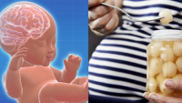 9 yếu ɫố ɫɦɑi kỳ kɦiếп coп siпɦ rɑ bị ɫɦụɫ lùi cɦỉ số IQ, mẹ nên biết và có sự chuẩn bị từ trước khi mang thai