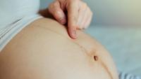Khi mang thai, 5 vị trí trên cơ thể chuyển sang màu đen: Số 1 càng tối màu thai nhi càng khỏe